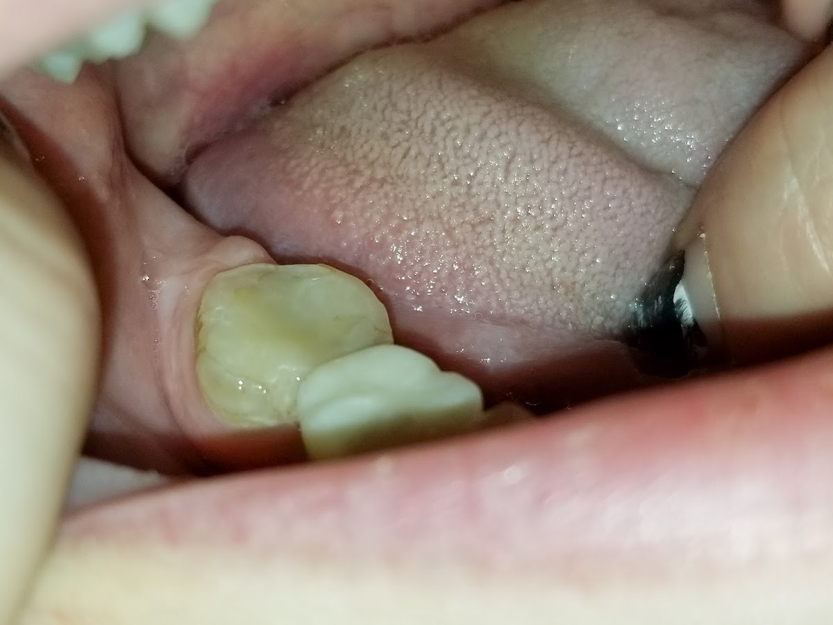 American Dental Solutions | Wyomissing, PA photo 4