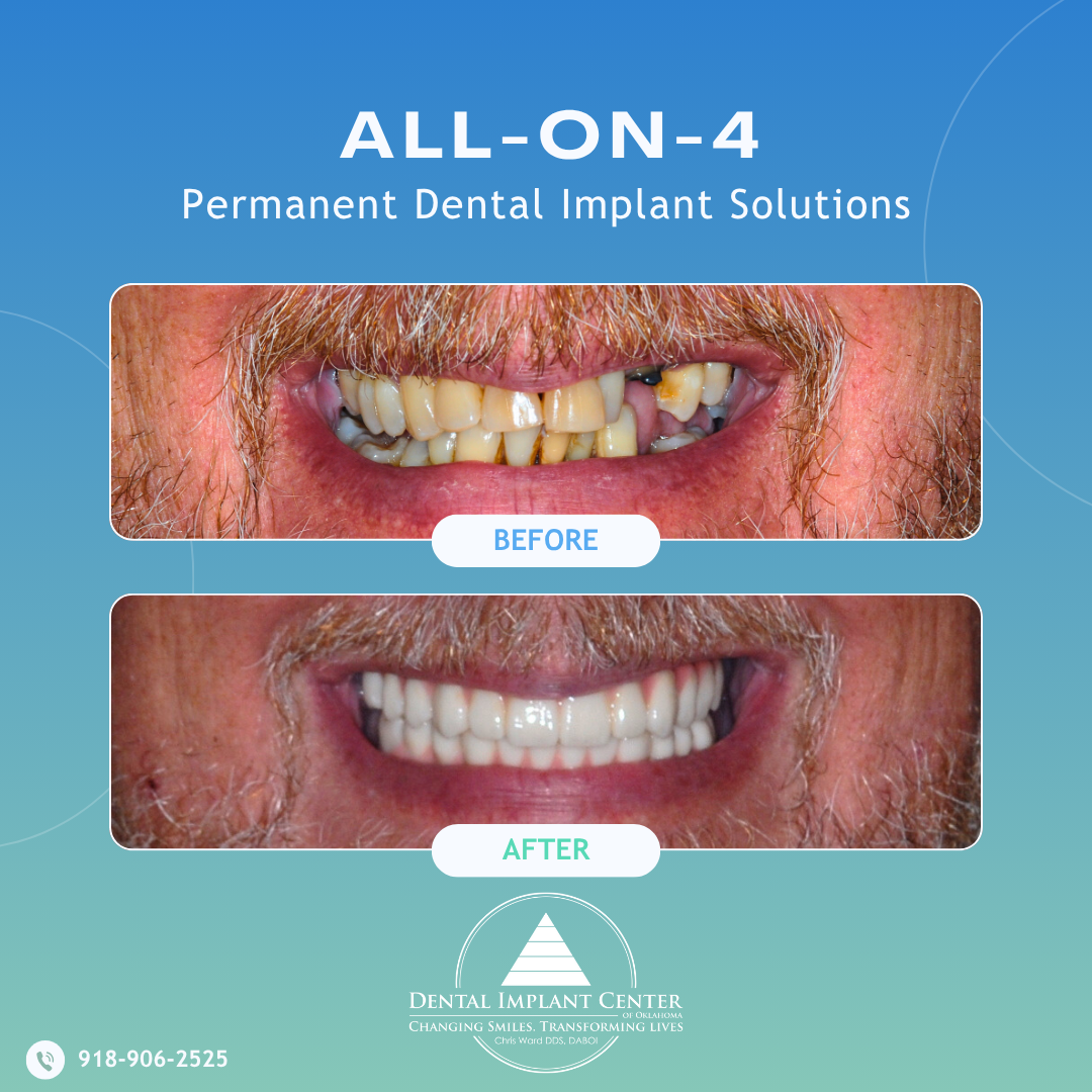 Dental Implant Center of Oklahoma photo 2