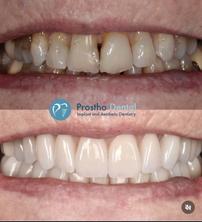 Prostho Dental photo 6