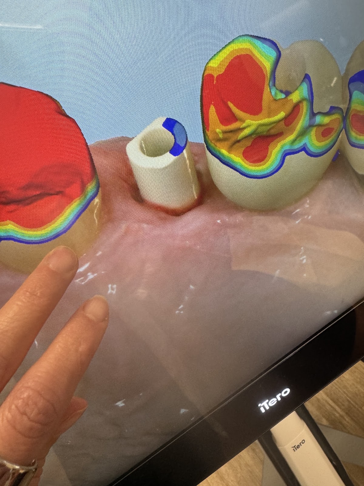 Polin Dental photo 6