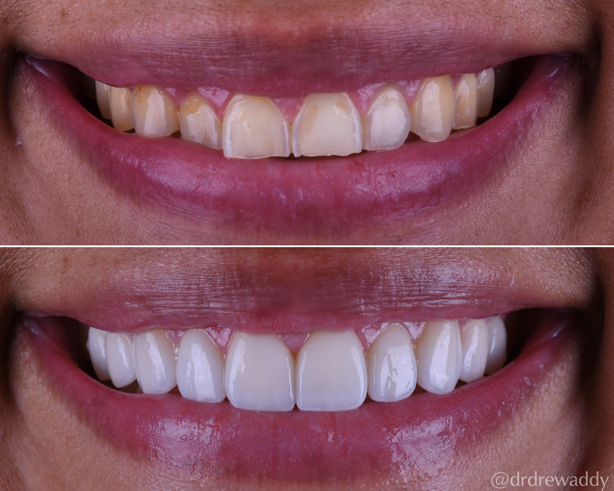 Carlsbad Beach Dental - Drew Addy, Dds photo 1
