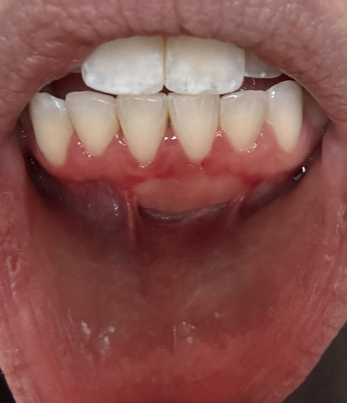 Periodontics and Dental Implants of Central Park photo 2