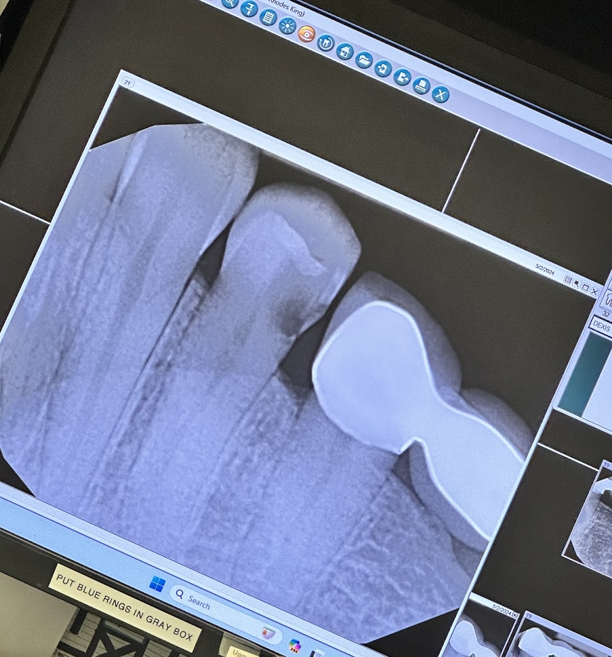 Aspen Dental - Gardendale photo 1