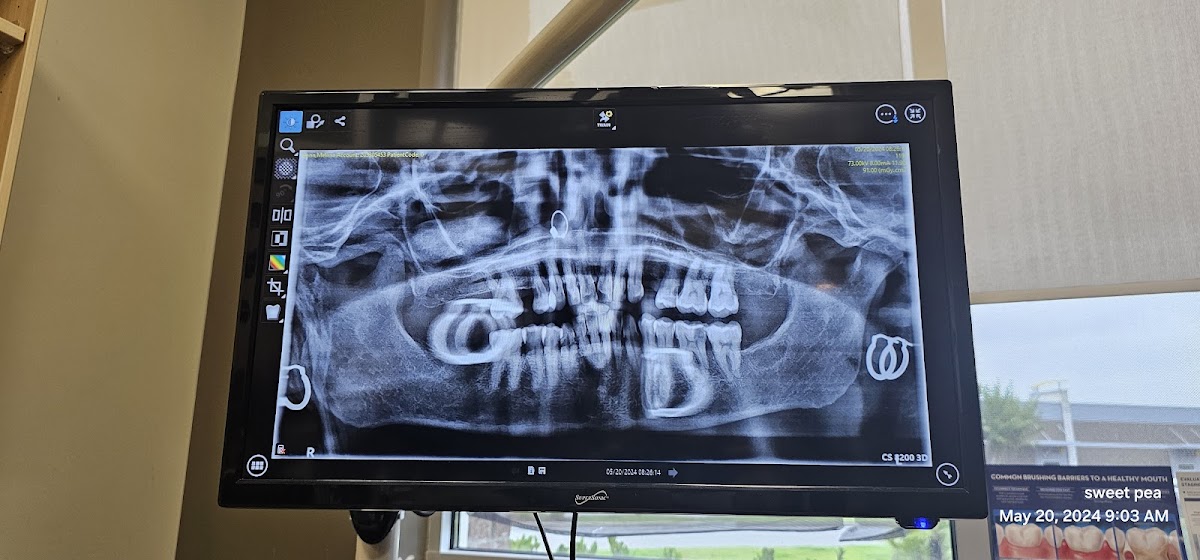 Aspen Dental - Brunswick photo 5