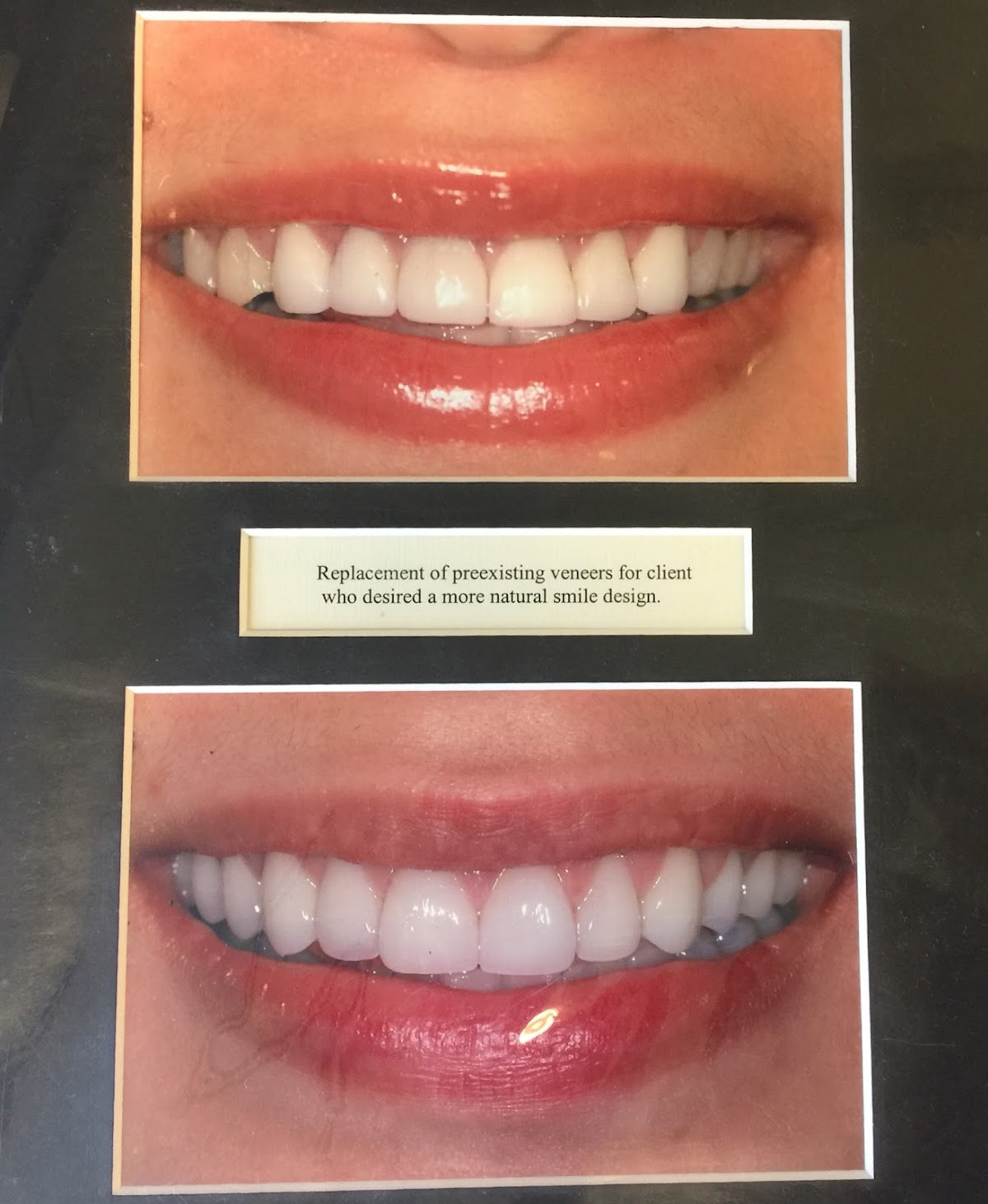 Btydental - Bellevue photo 6