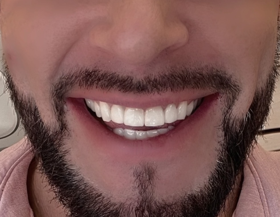 Aspen Dental - Manchester photo 2