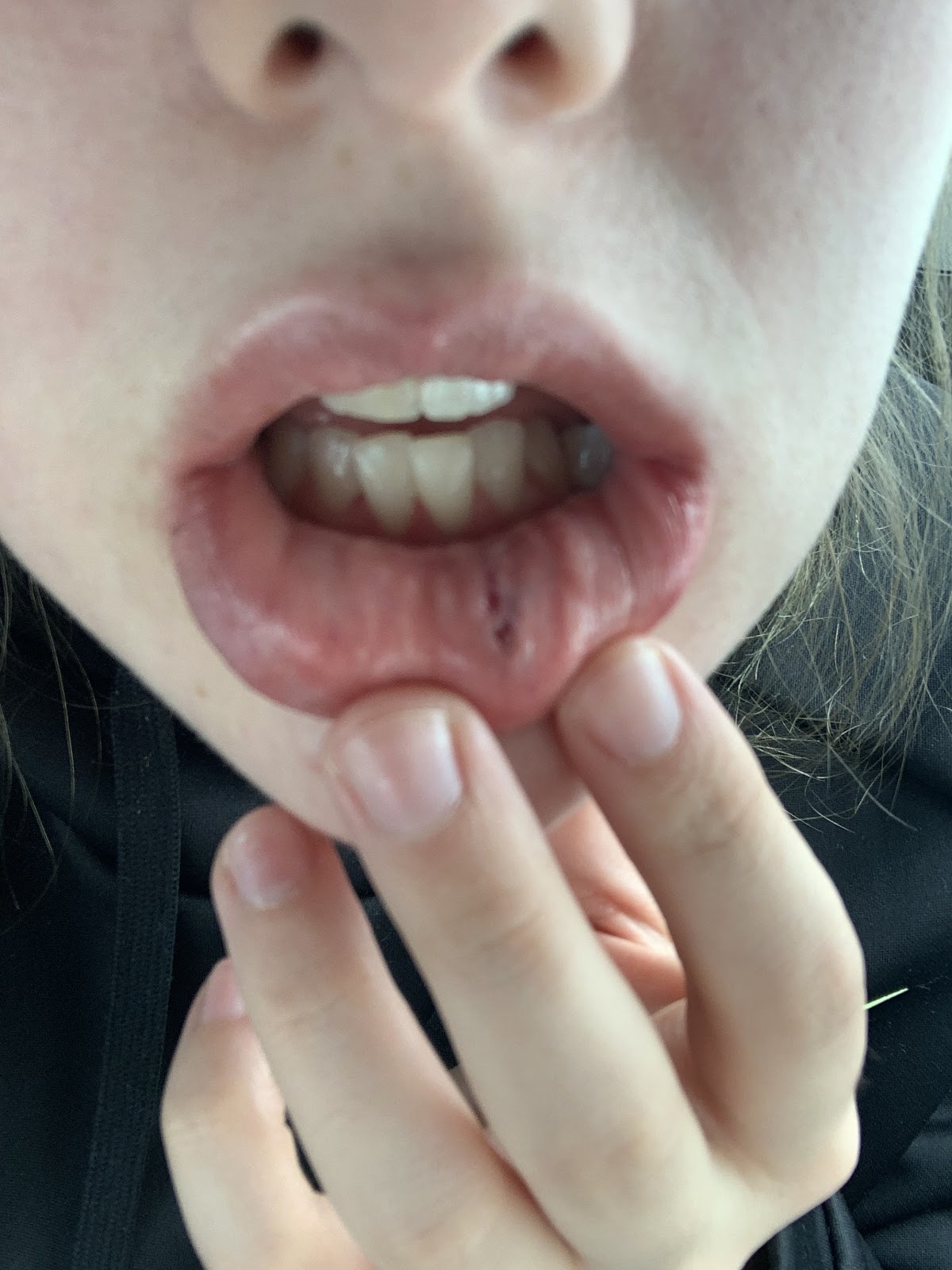 Aspen Dental - Manchester photo 3