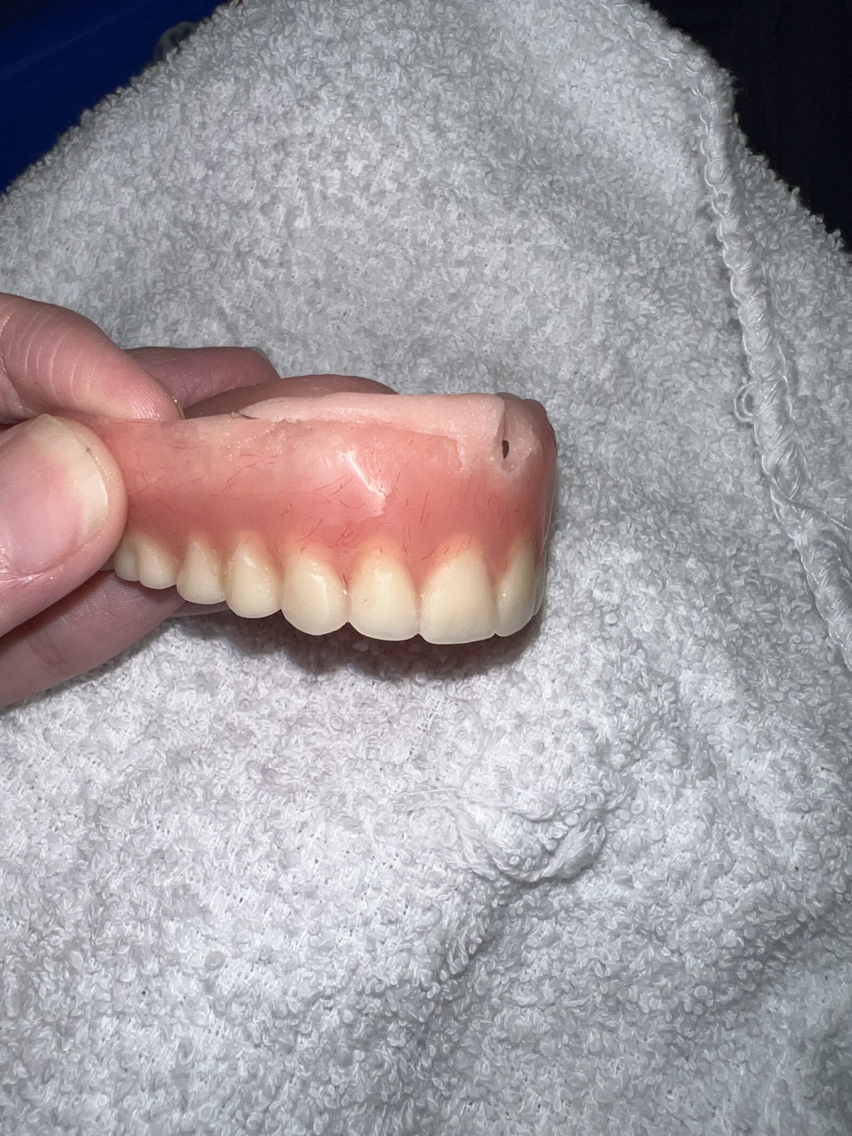 Affordable Dentures & Implants - Fort Smith photo 5