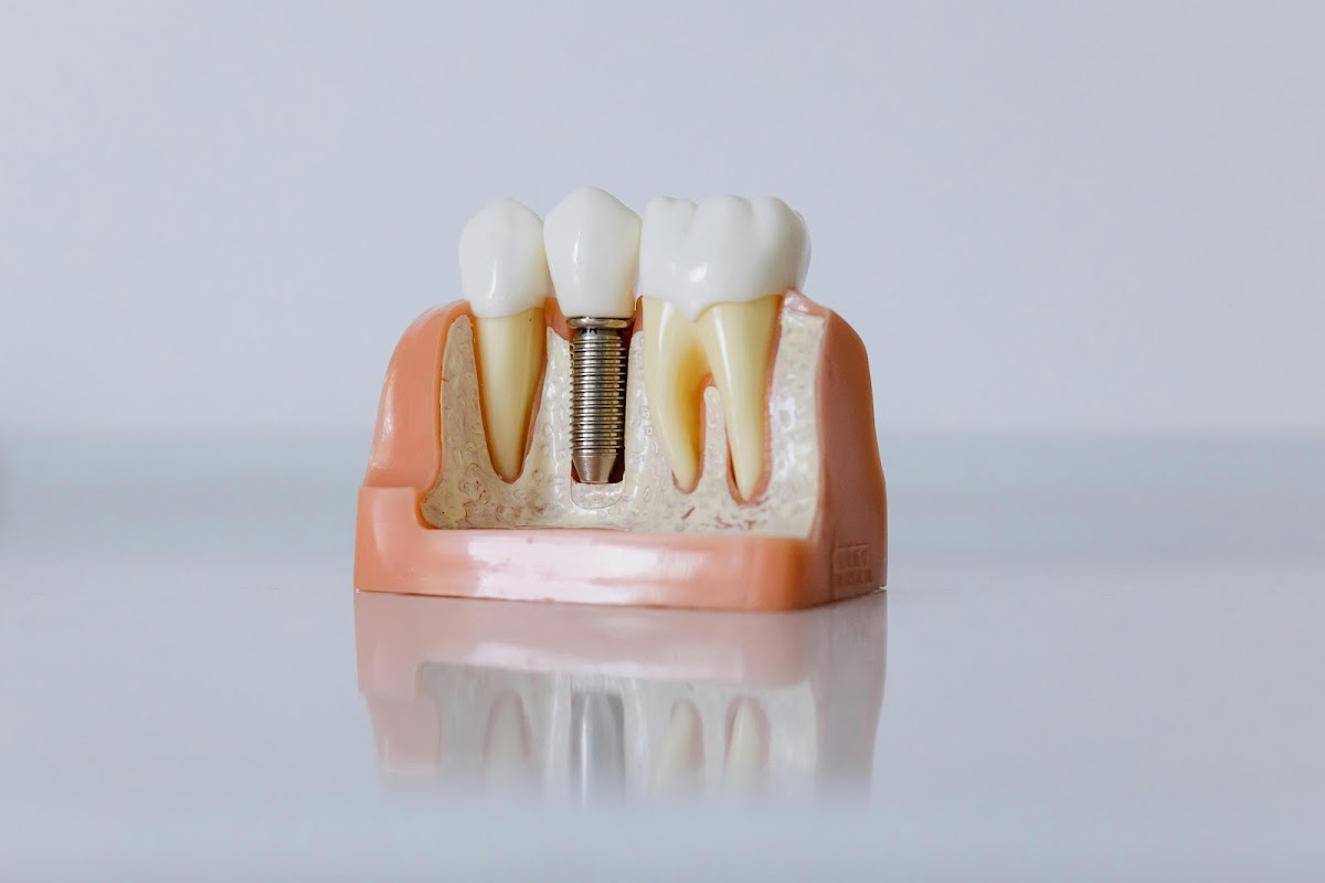 Pinnacle Periodontics & Dental Implants photo 1
