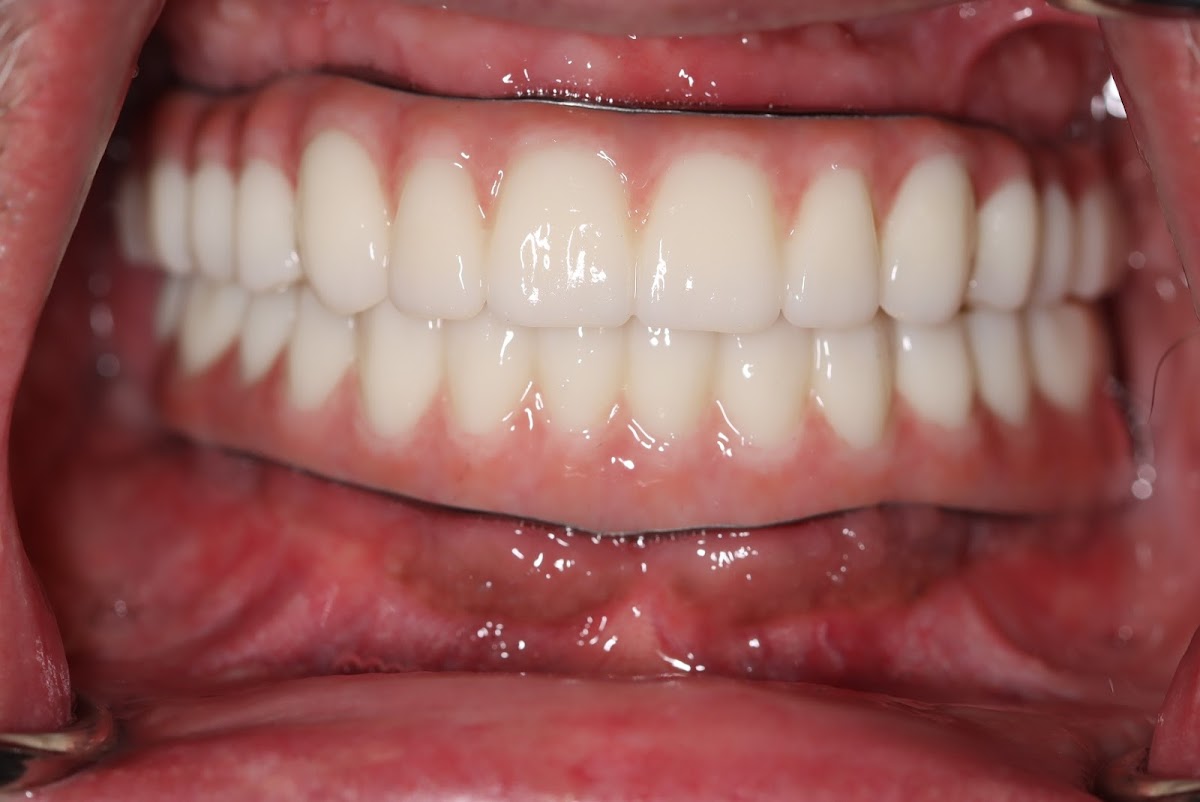 Ora Dental Implant Studio photo 1