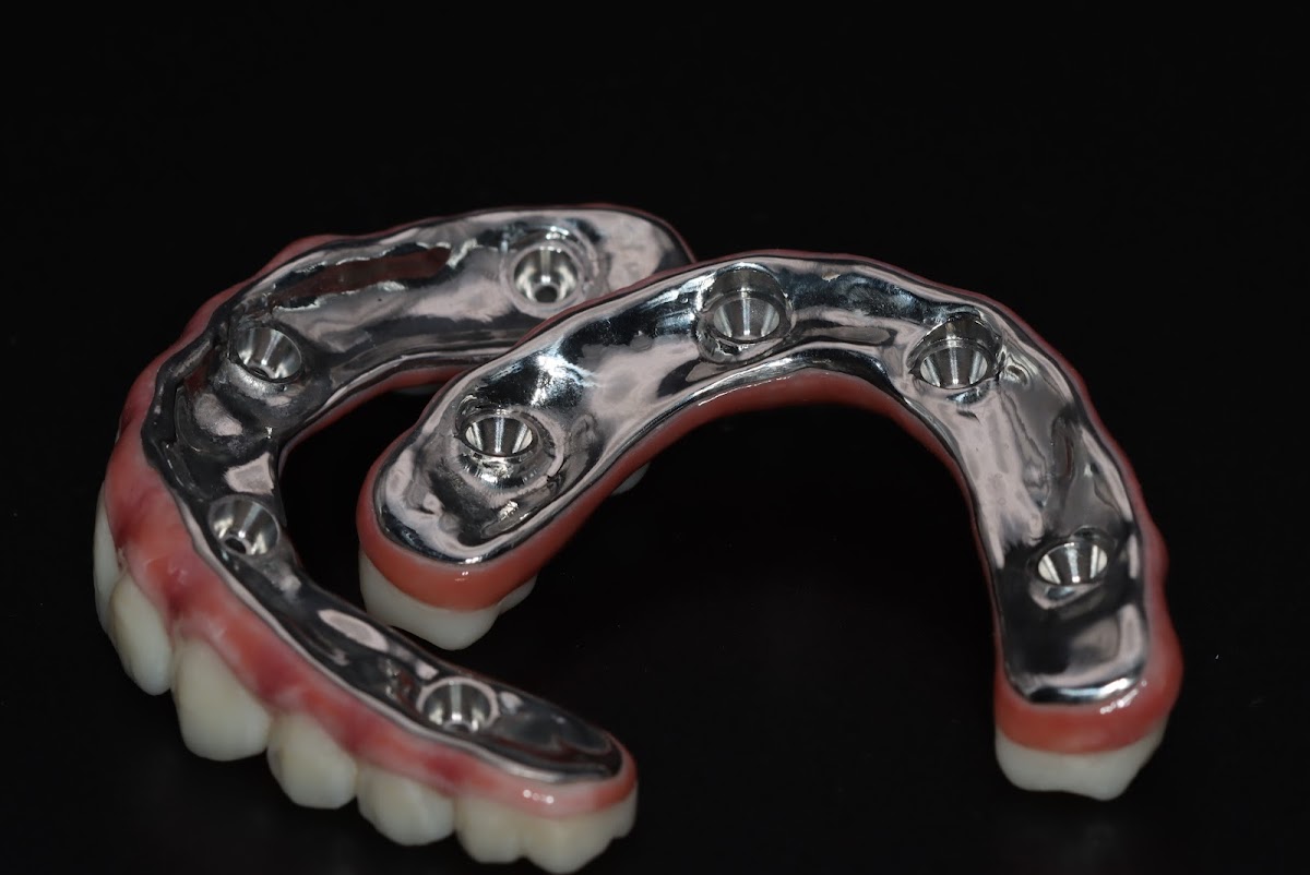 Ora Dental Implant Studio photo 6