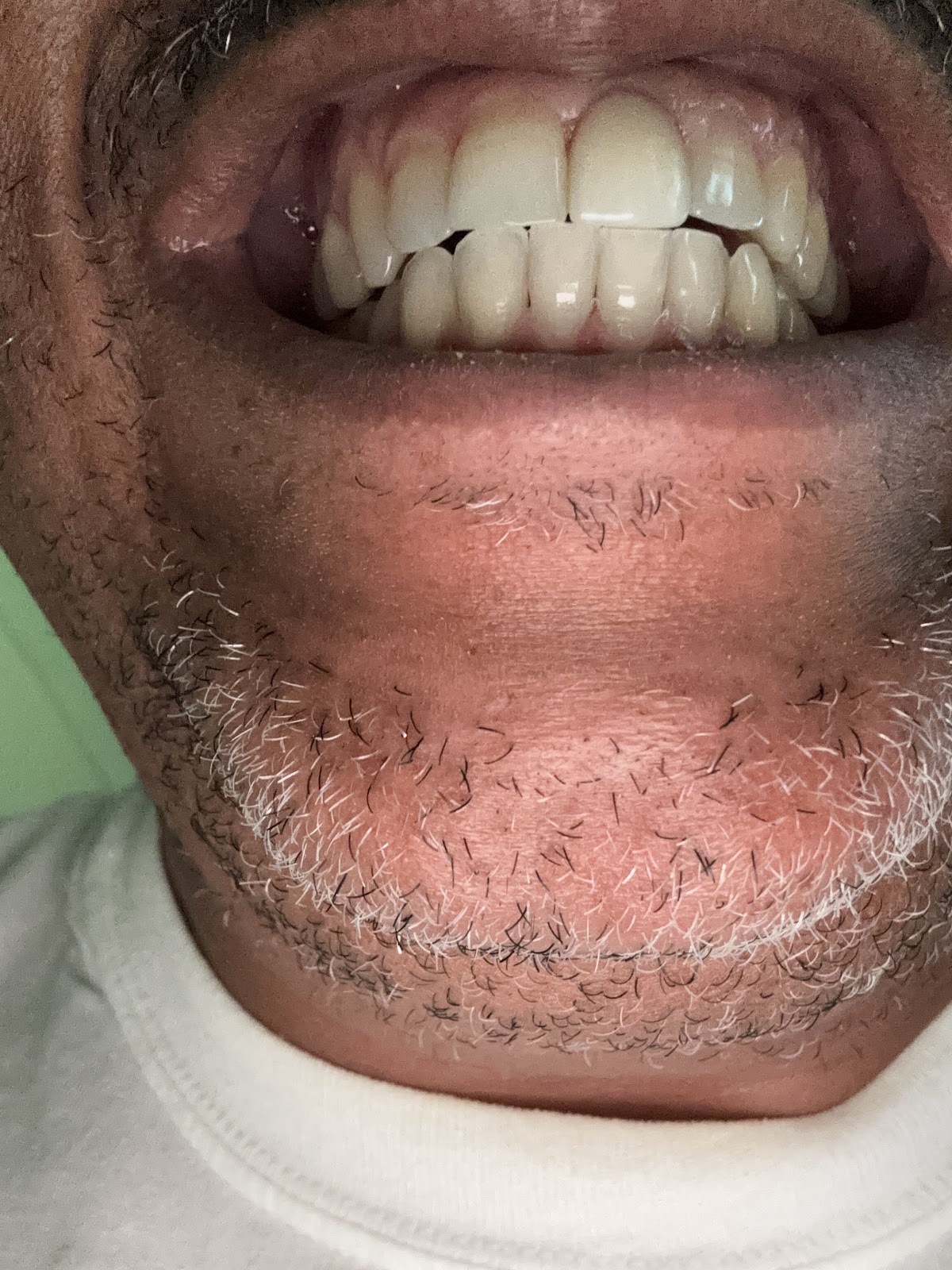 Dental Solutions of Clinton photo 5