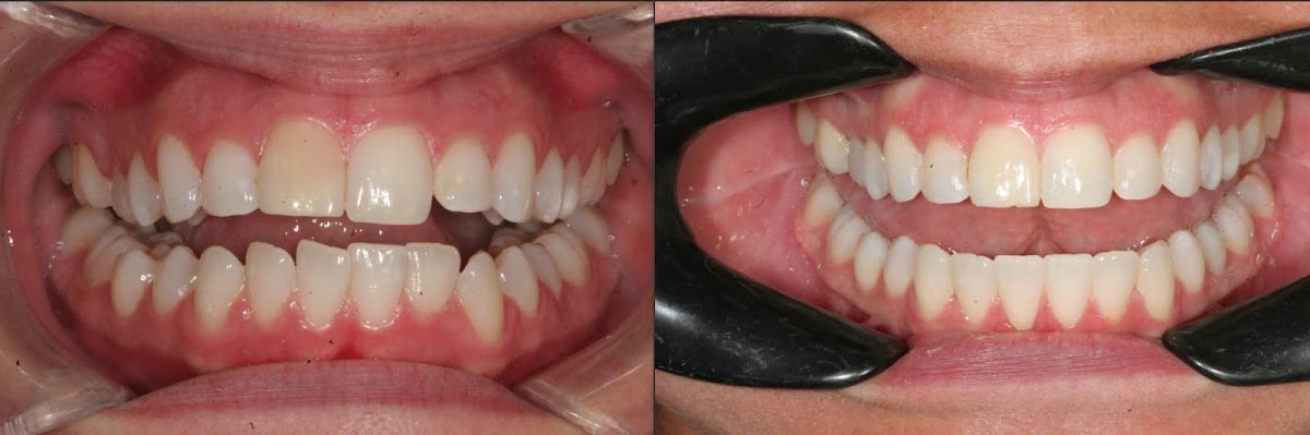 Center for Advanced Cosmetic Dentistry photo 6