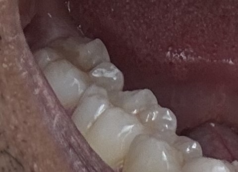 Michael D. Clark, DDS photo 1