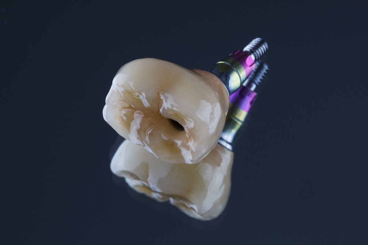 Arizona 3d Dental Lab photo 3