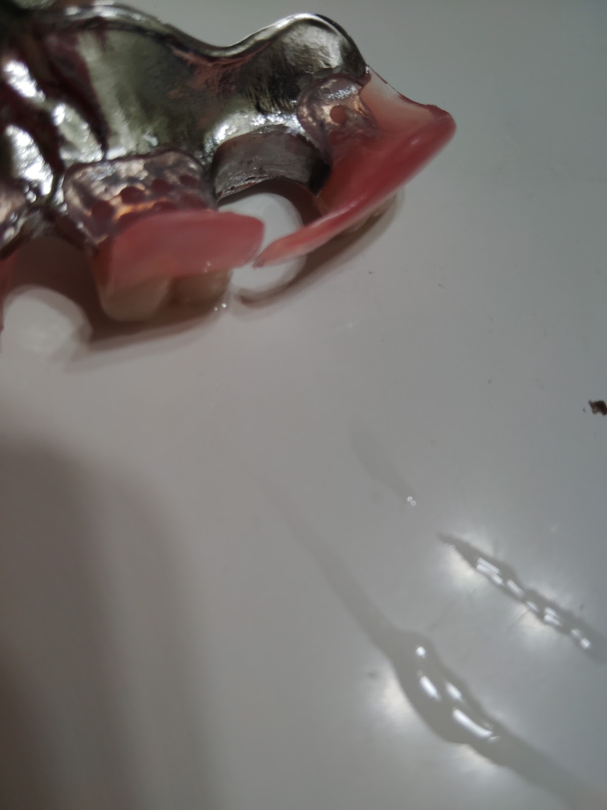 Aspen Dental - Crestwood photo 5