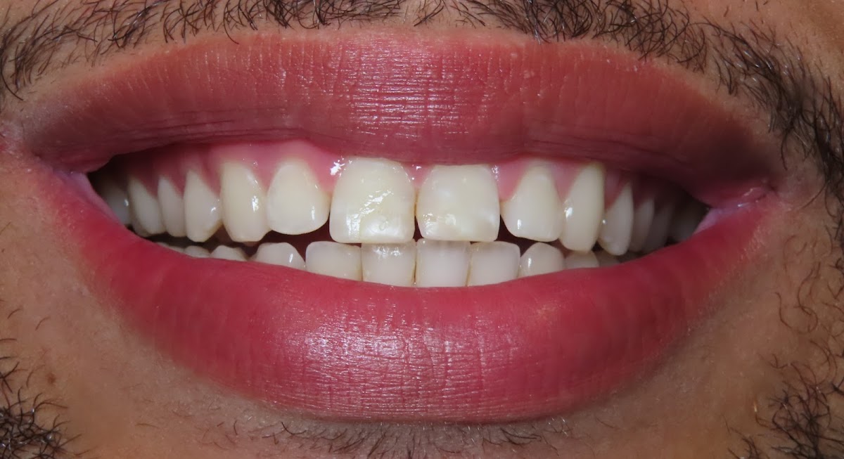 Bling Dental photo 6