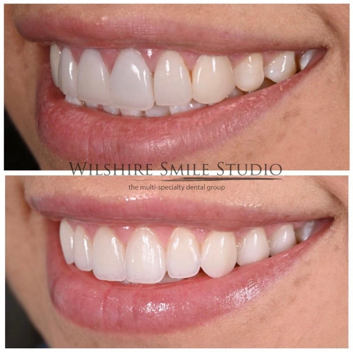 Wilshire Smile Studio photo 2