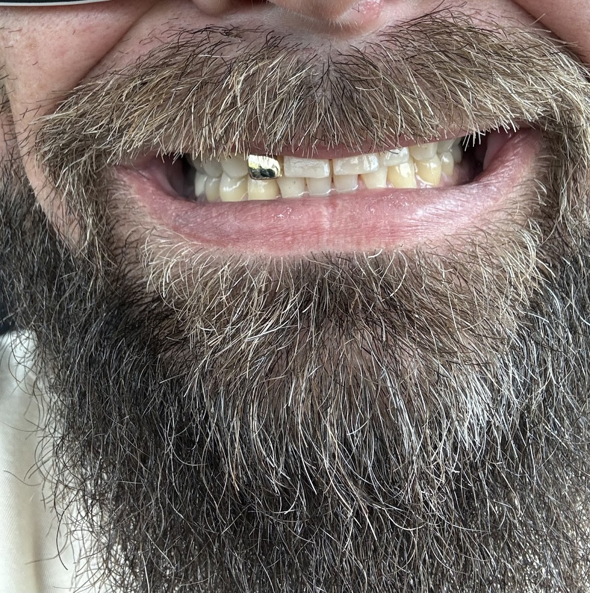 The Toothbooth: Joel M Booth, DDS photo 3