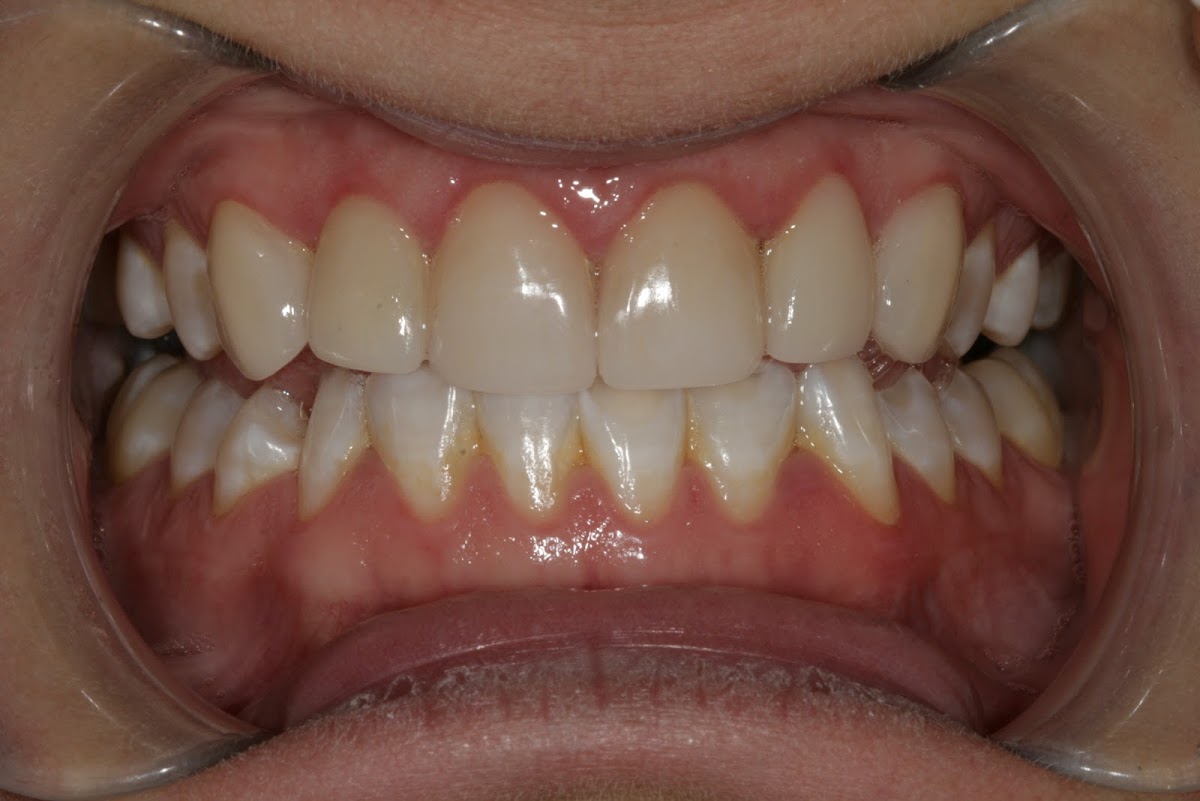 Mountain Health Dentistry photo 3