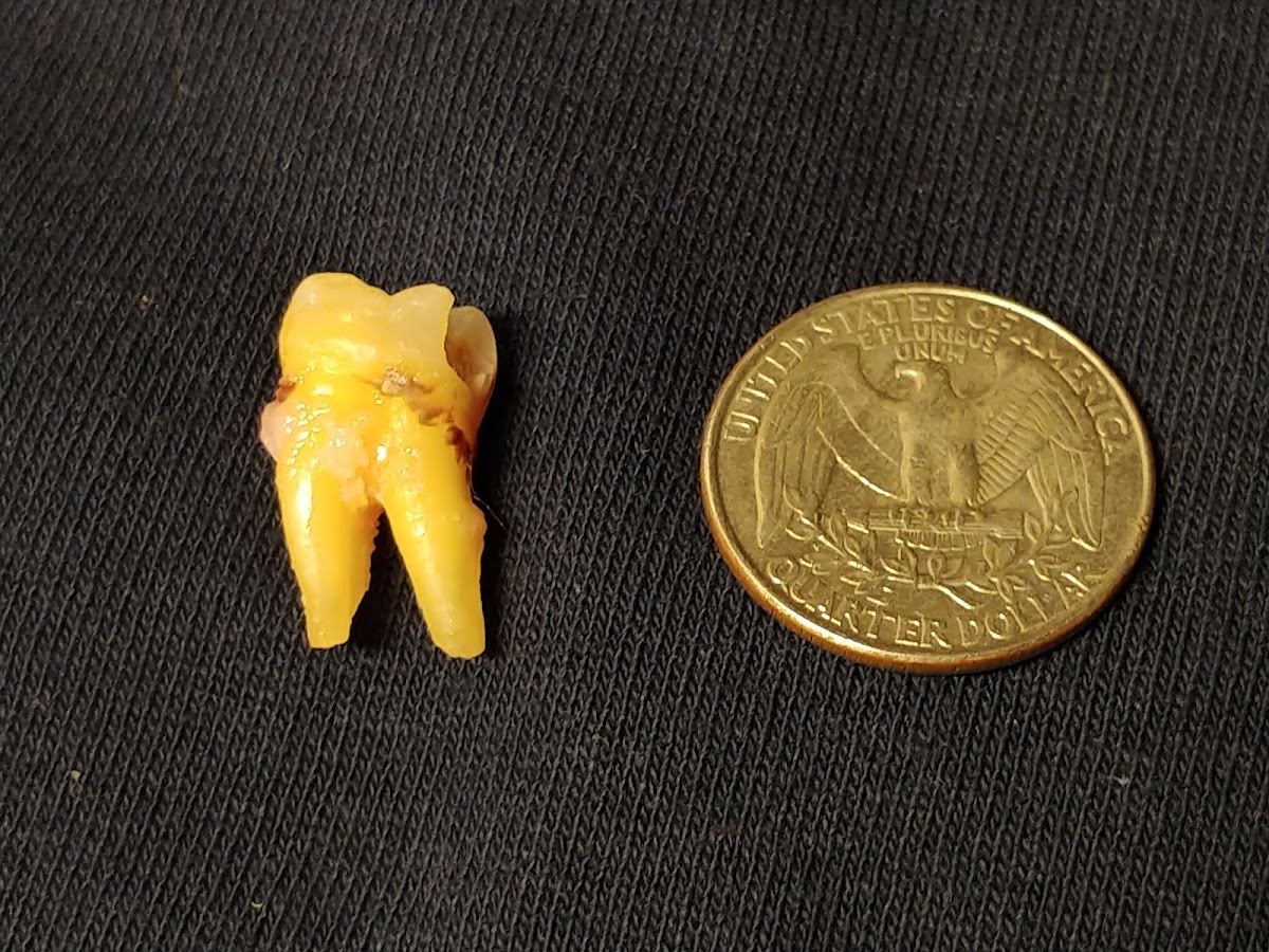 Four Corners Oral Surgery: Michael W. Johnson, MD, DDS photo 4