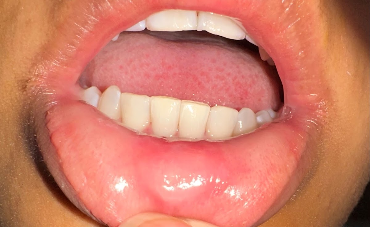 Midwest Dental - Green Bay Northeast photo 3