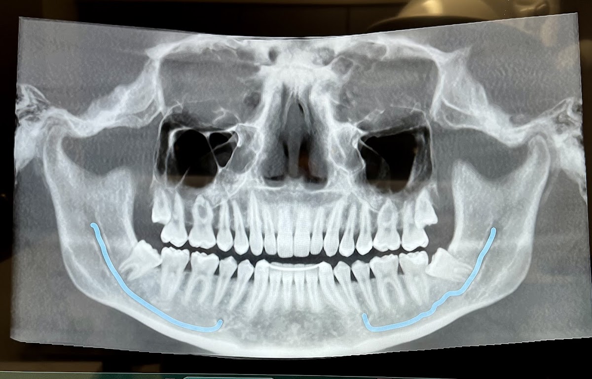 South Mississippi Oral Surgery & Implant Center photo 5