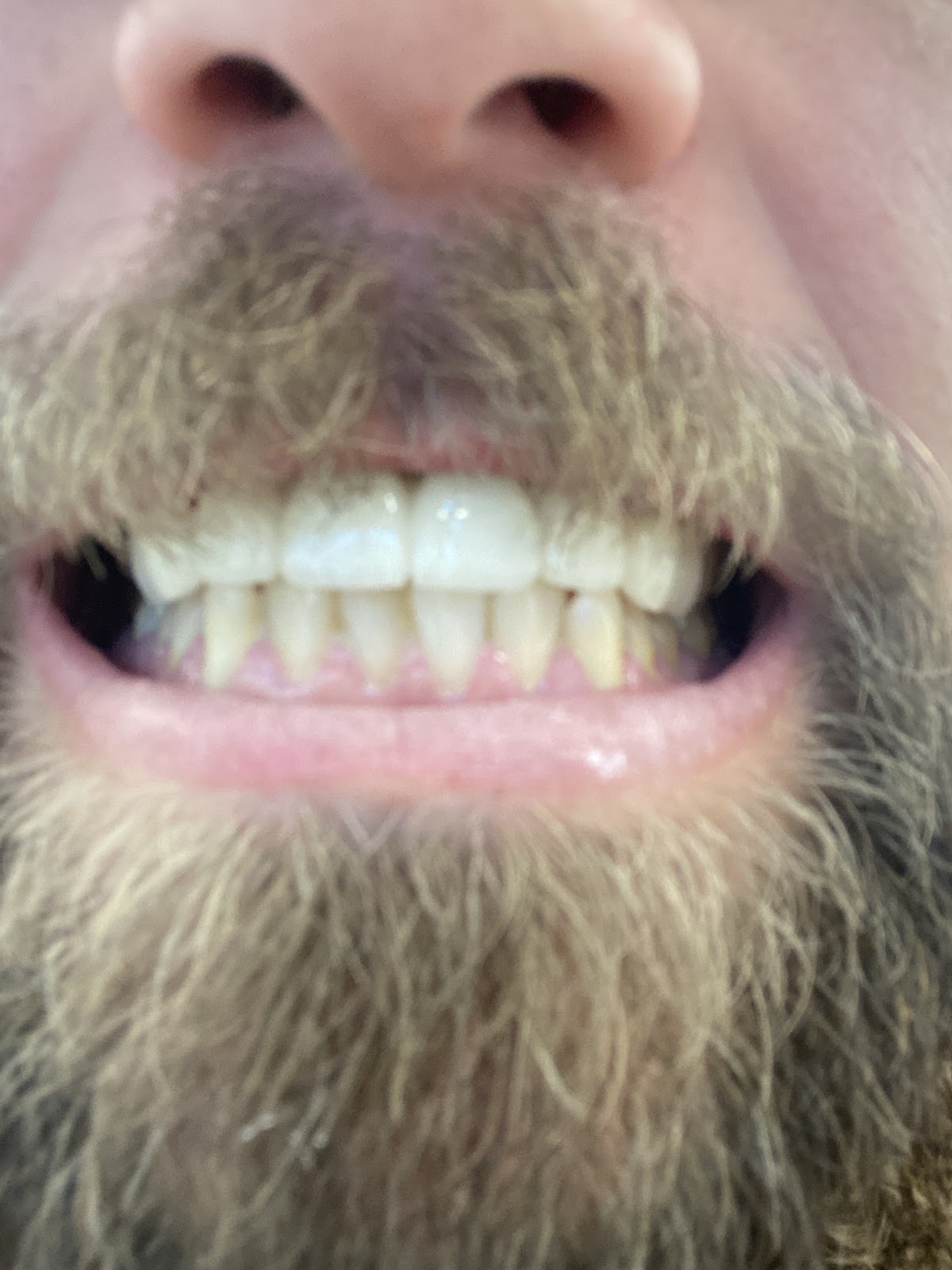 Sage Dental of Gainesville, Ga photo 3
