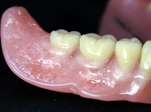 Primebilt Dental Lab photo 1