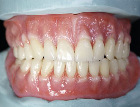 Primebilt Dental Lab photo 2