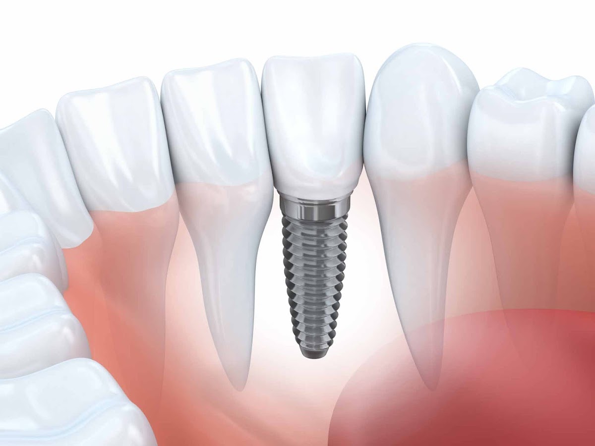 Primebilt Dental Lab photo 3