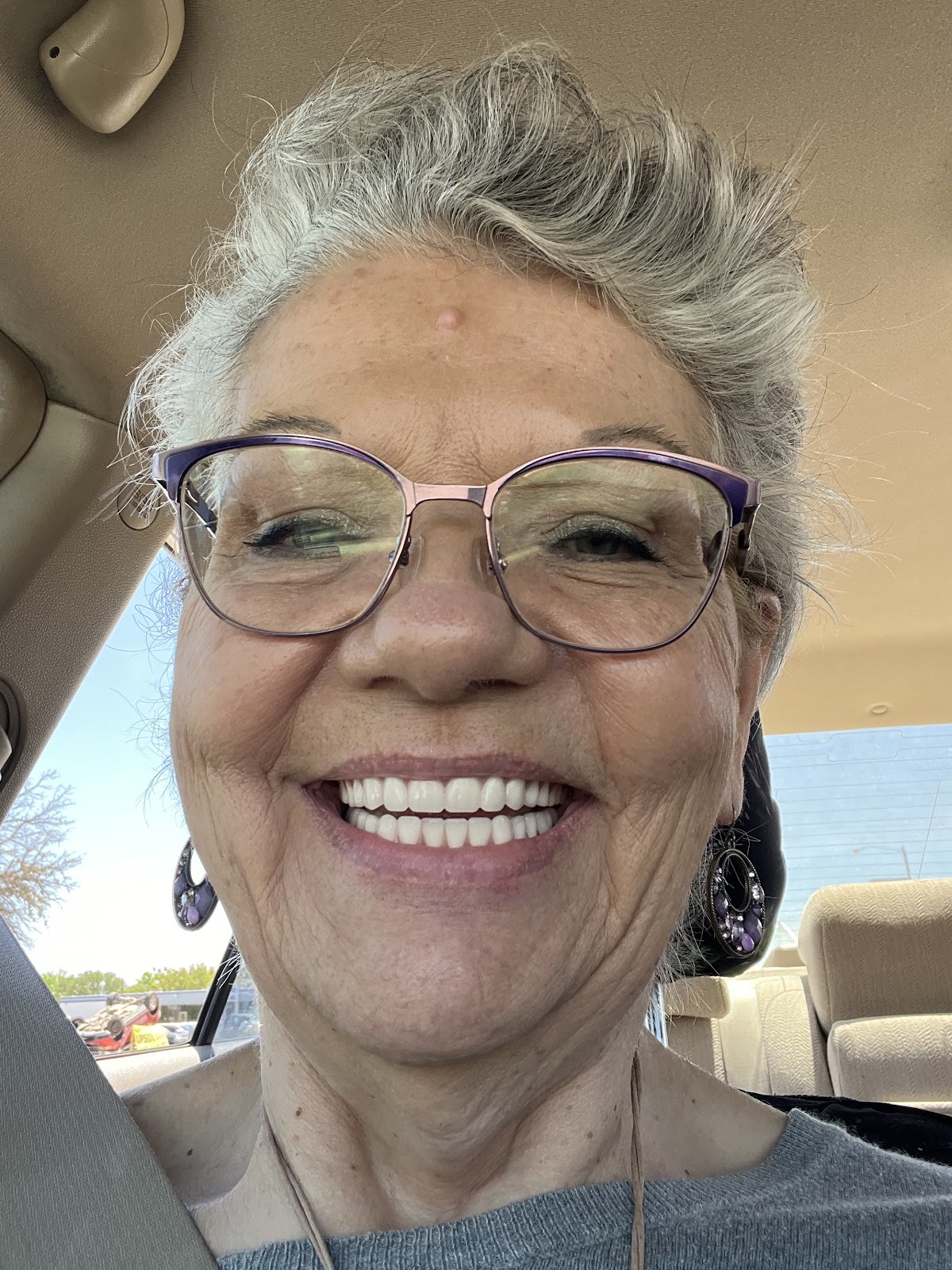 Affordable Dentures & Implants - Lubbock photo 5