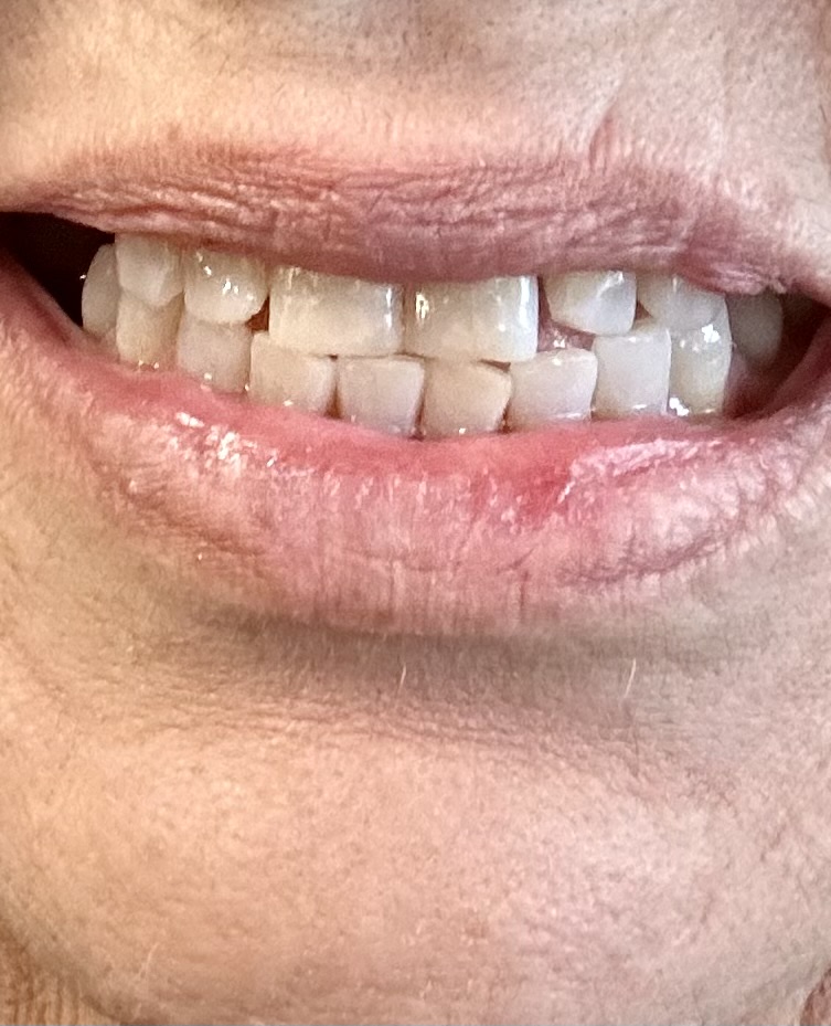 Bliss Dental & Orthodontics - Odessa photo 4