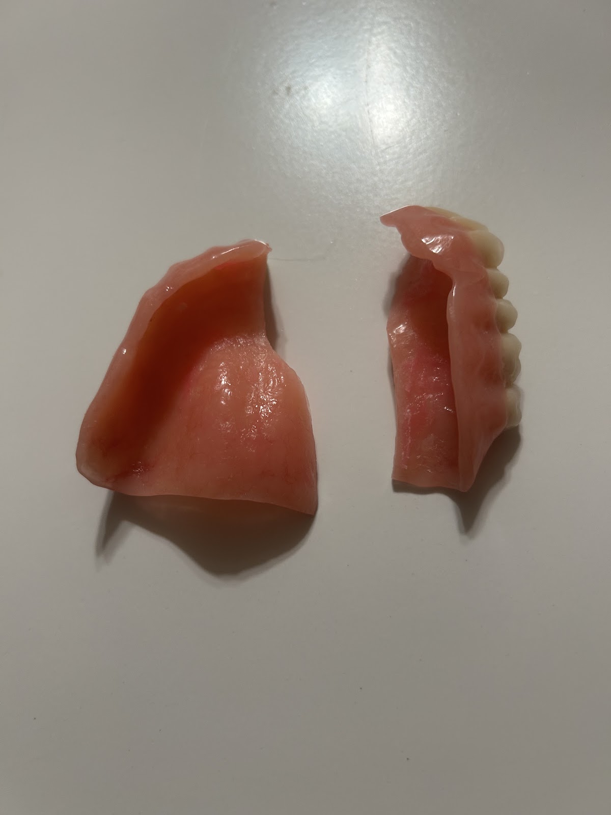 Aspen Dental - Bolingbrook photo 5