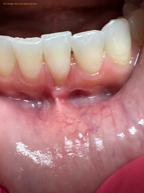 Hillsborough Periodontics and Implants Hana C Hobbs DDS, Ms photo 2
