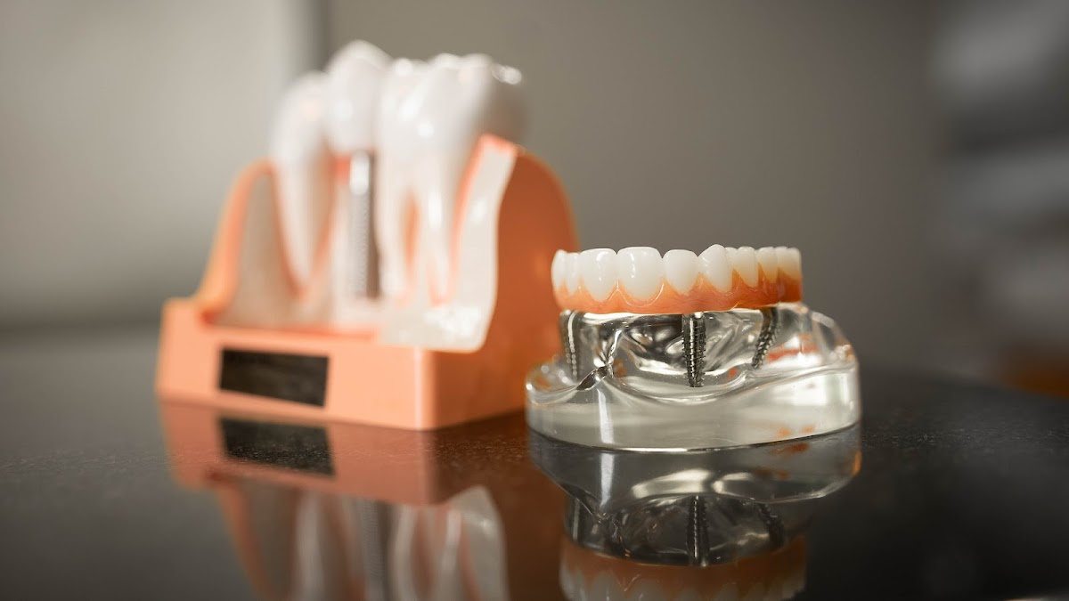 Grand Dental Implant Centers photo 4