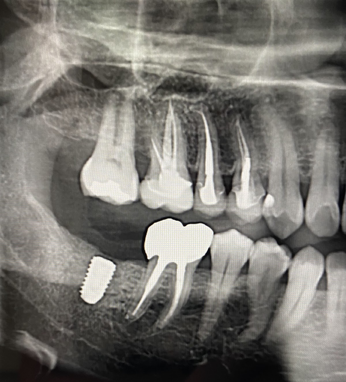 W. Jeffrey Battles, DMD, Pc---dentist Accepting New Patients! ¡se Habla Español! Se Aceptan Nuevos Pacientes! photo 3