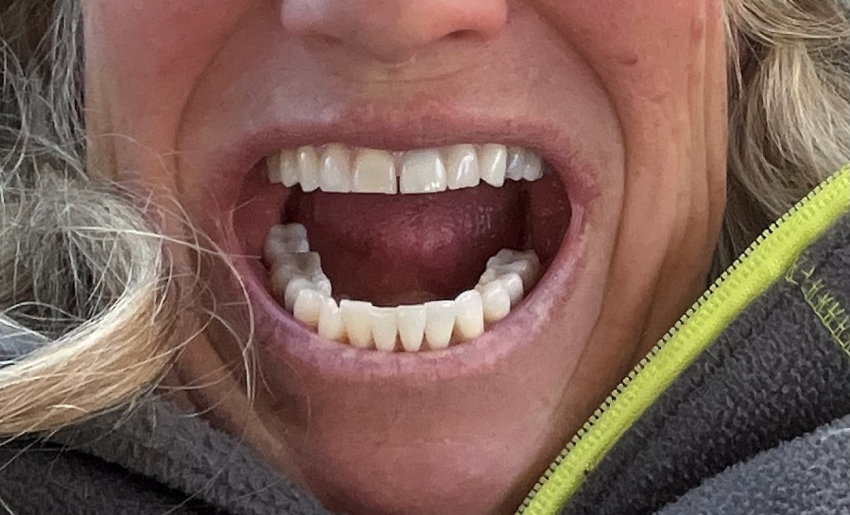 Pickle Prosthodontics photo 2