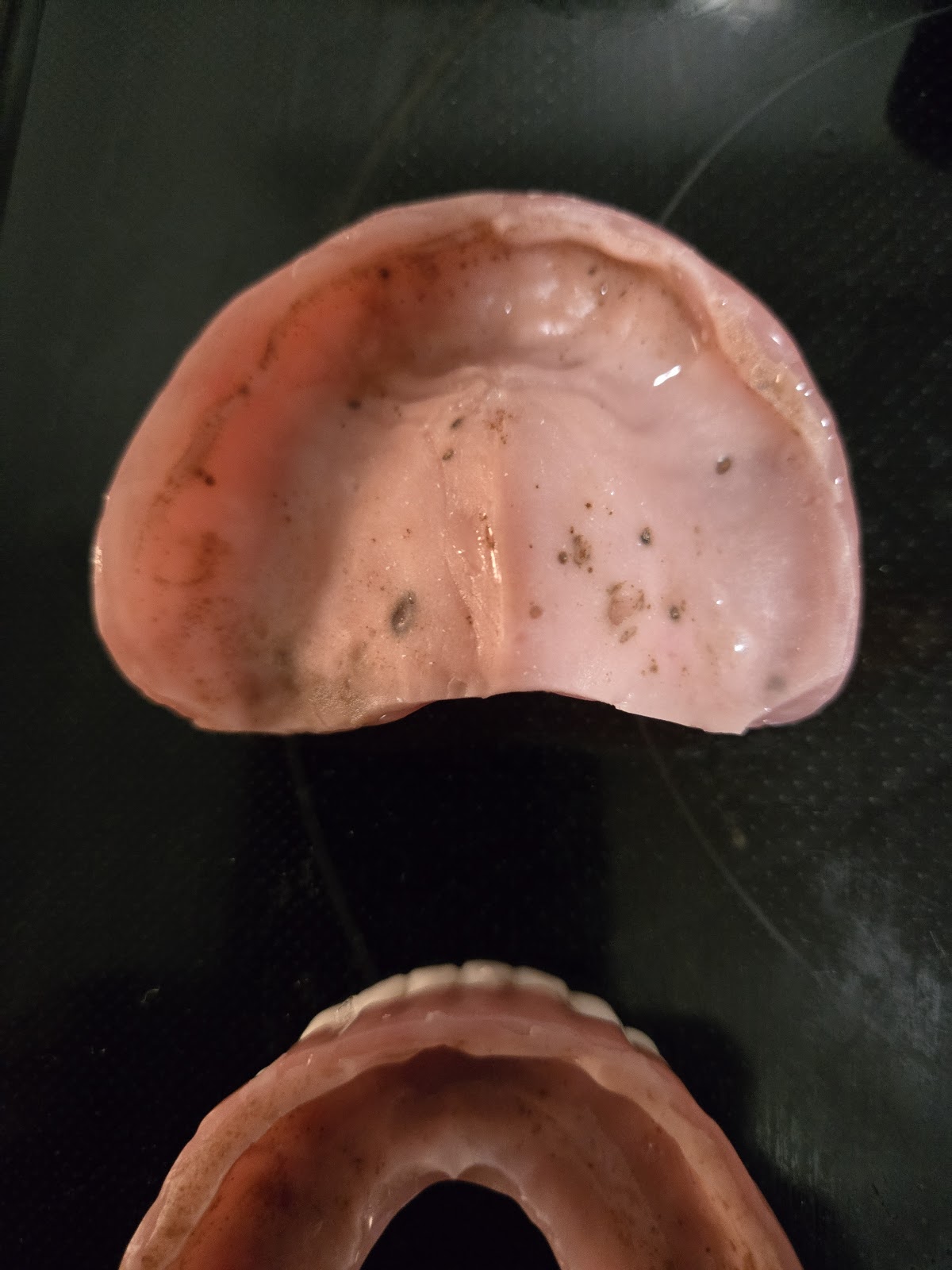 Affordable Dentures & Implants - North Richmond photo 3