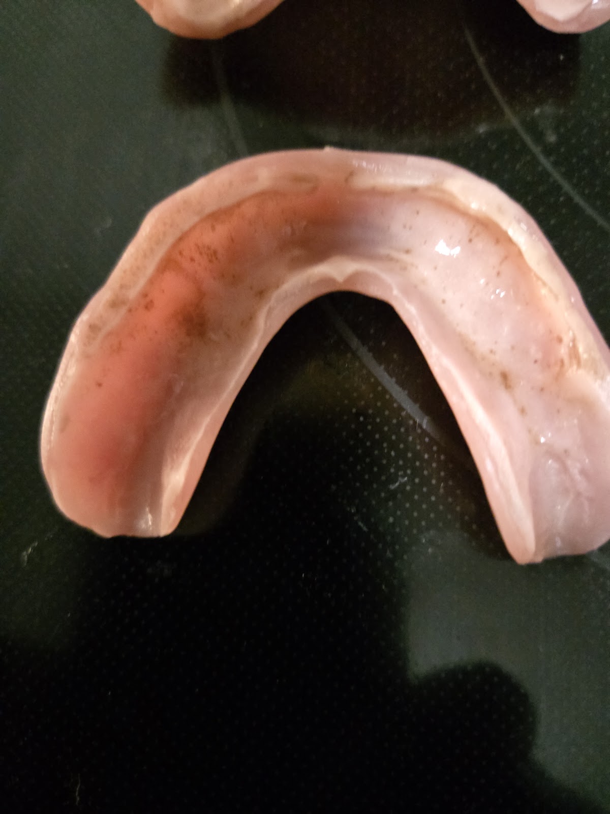 Affordable Dentures & Implants - North Richmond photo 4