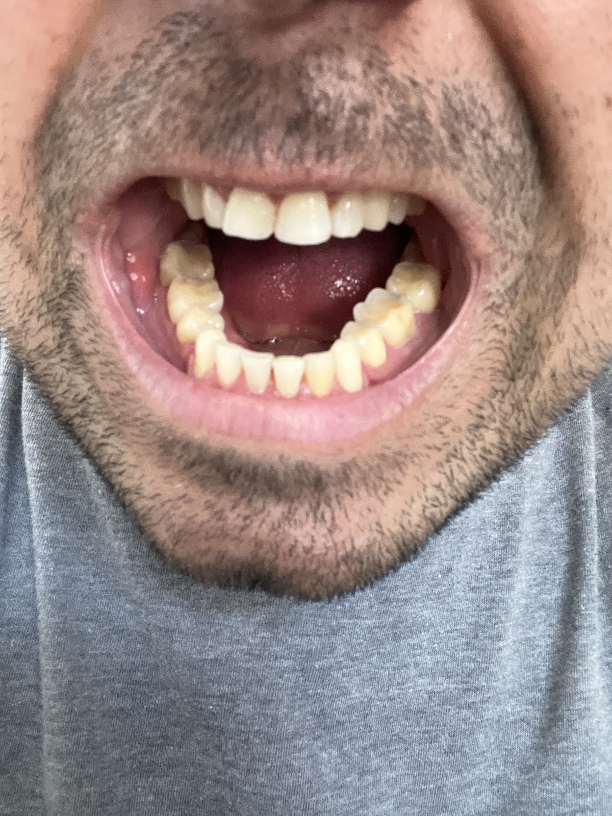 Summit Dental Health photo 1