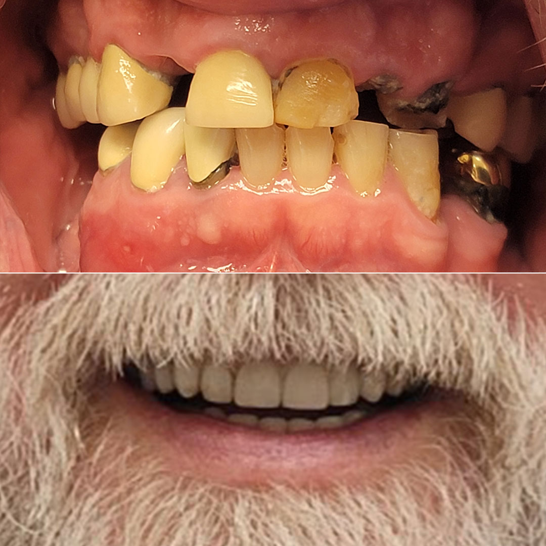 Advanced Dentistry & Implant Center photo 1