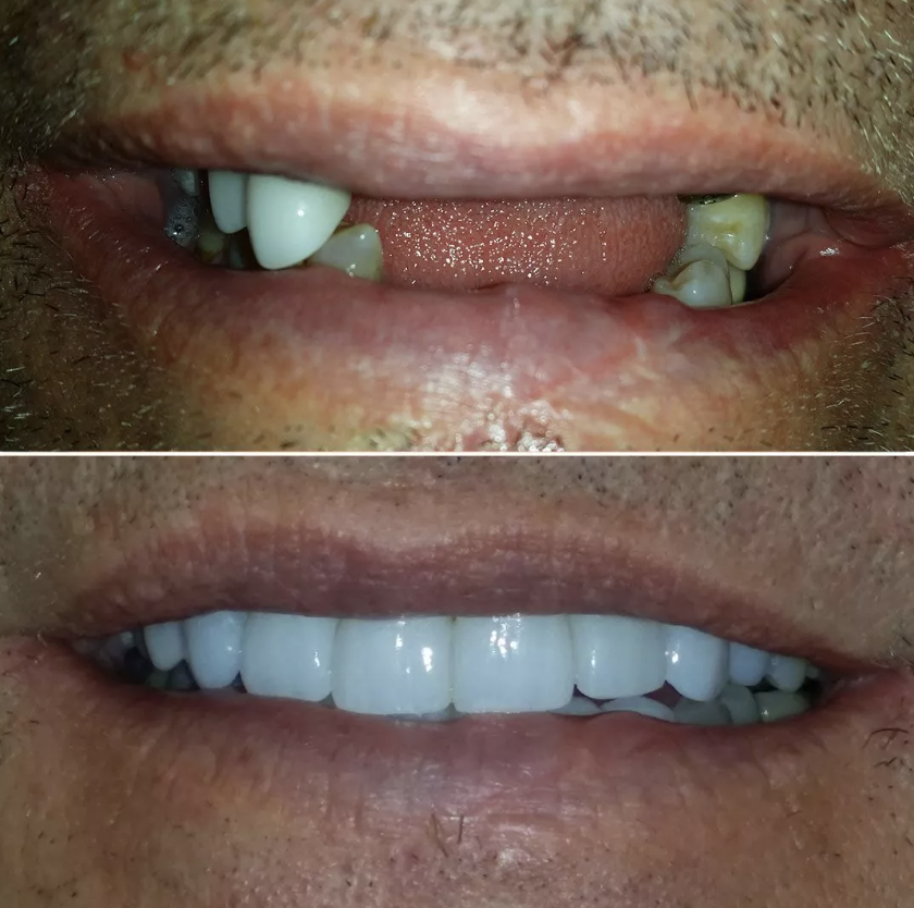 Advanced Dentistry & Implant Center photo 2