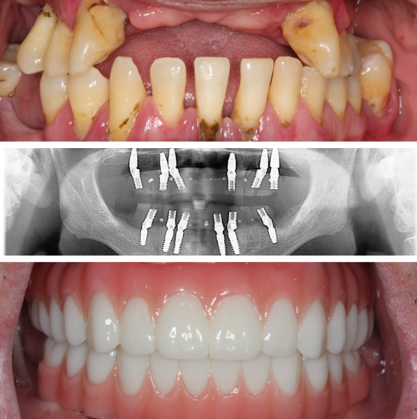 Westchester Dental Implants and Periodontics, PLLC photo 2