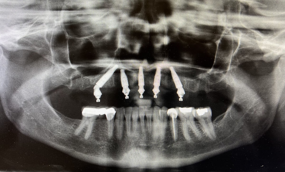 Monterey Dental Implant Center photo 1