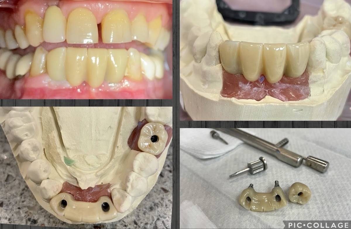 Monterey Dental Implant Center photo 2