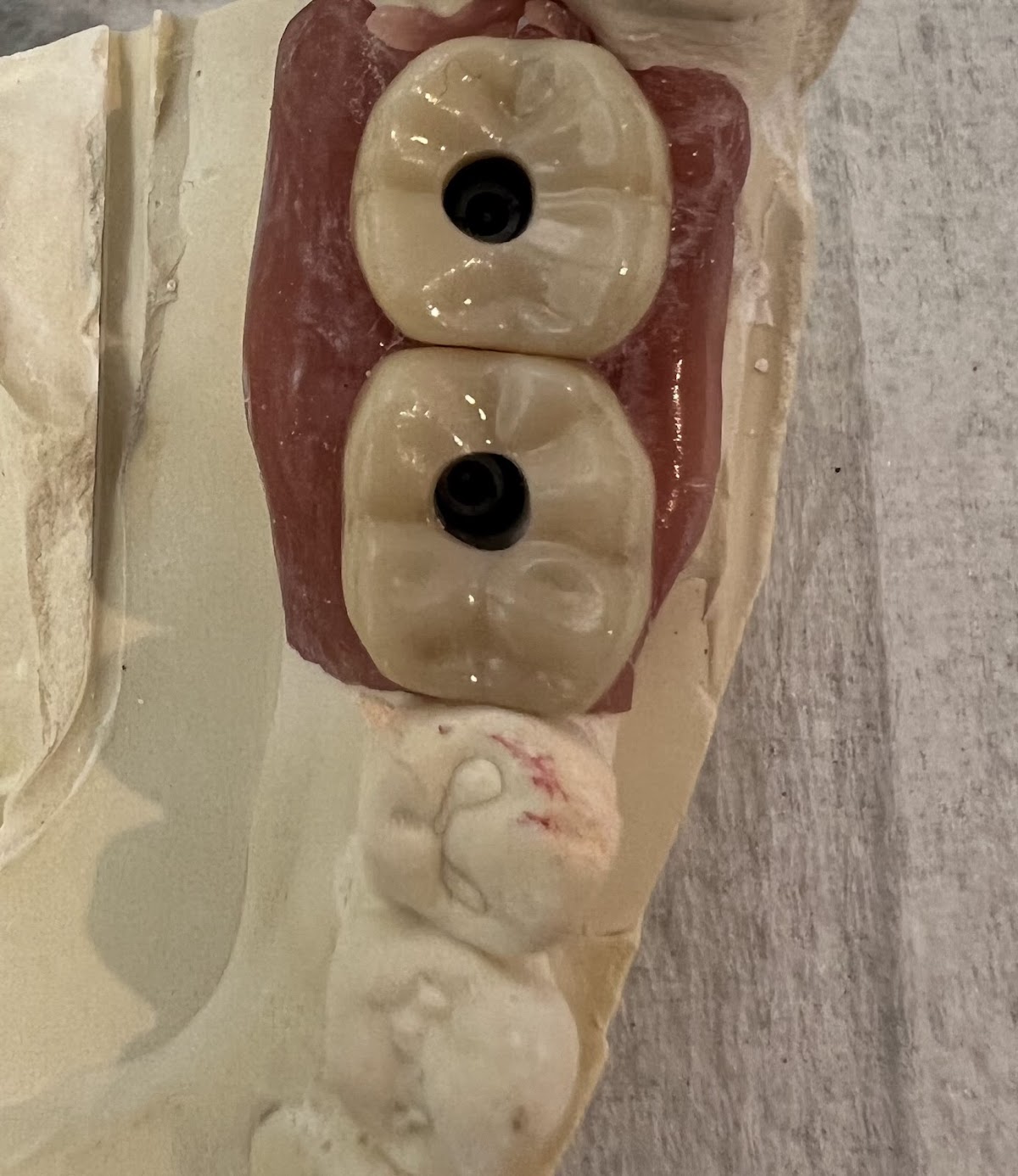 Monterey Dental Implant Center photo 3