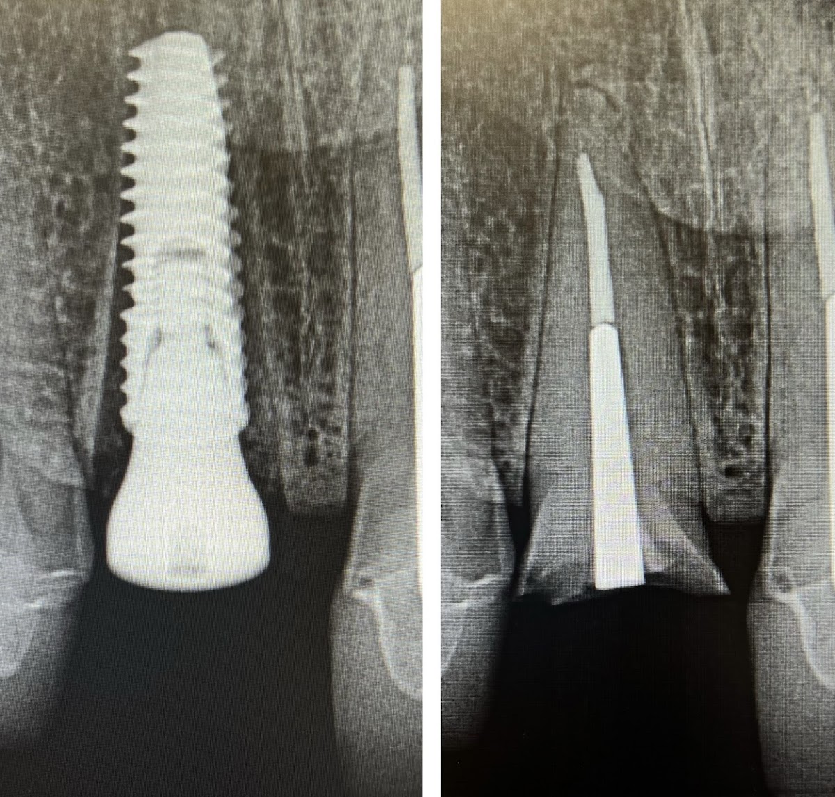 Monterey Dental Implant Center photo 5