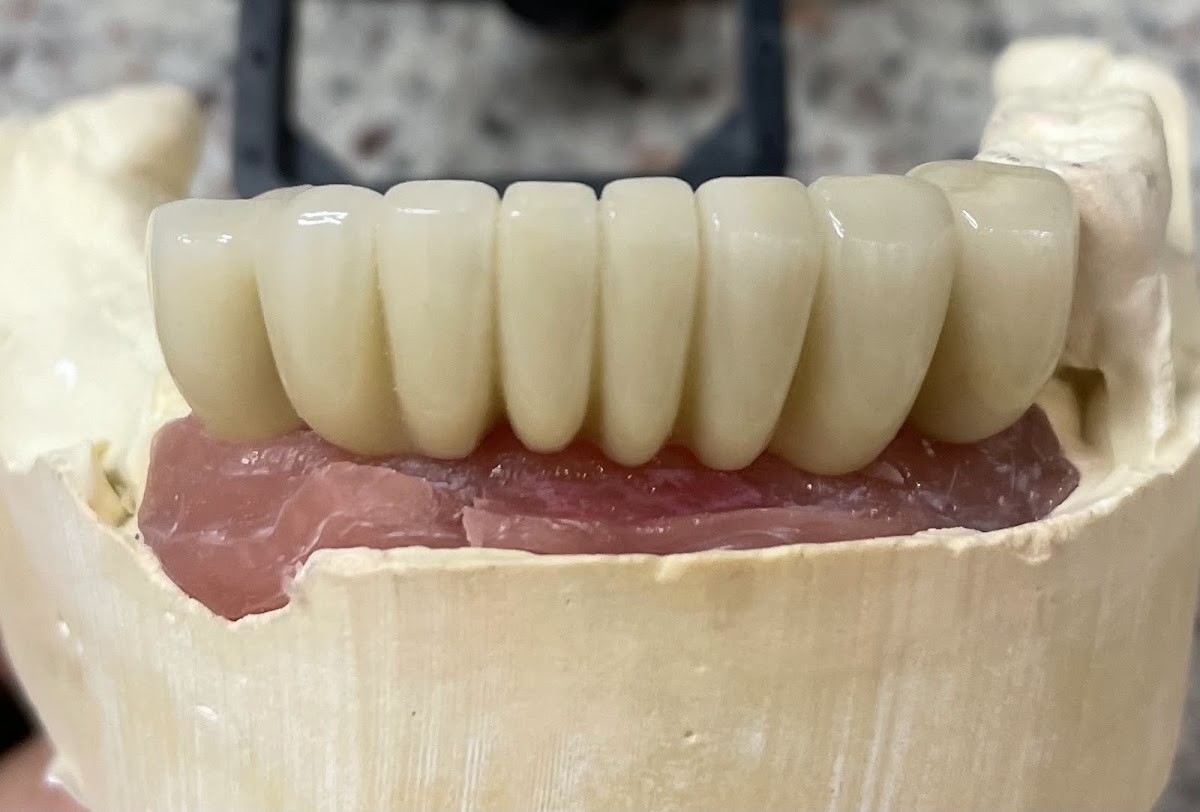 Monterey Dental Implant Center photo 6
