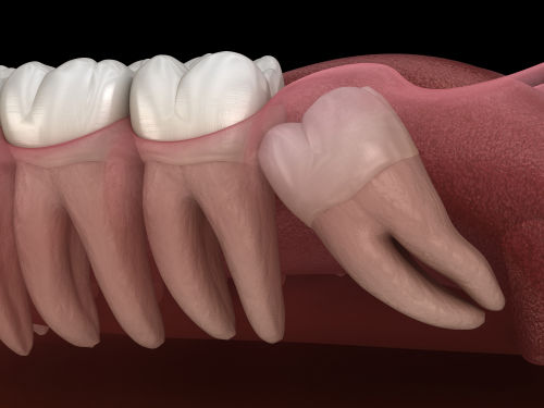Sunrise Dental Sequim photo 5